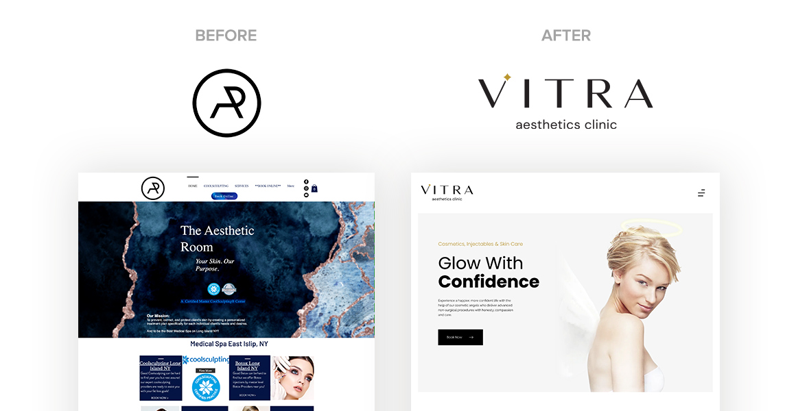 Vitra Aesthetics Clinic Before and After